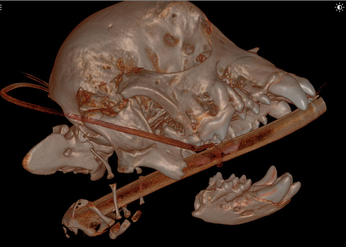 Rostral_MNectomy_Aug_2023_CT_01