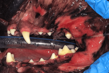 last procedure need CME left