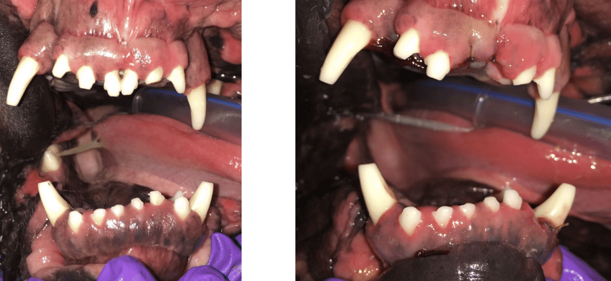 Left - Before Extractions Right - After Extractions