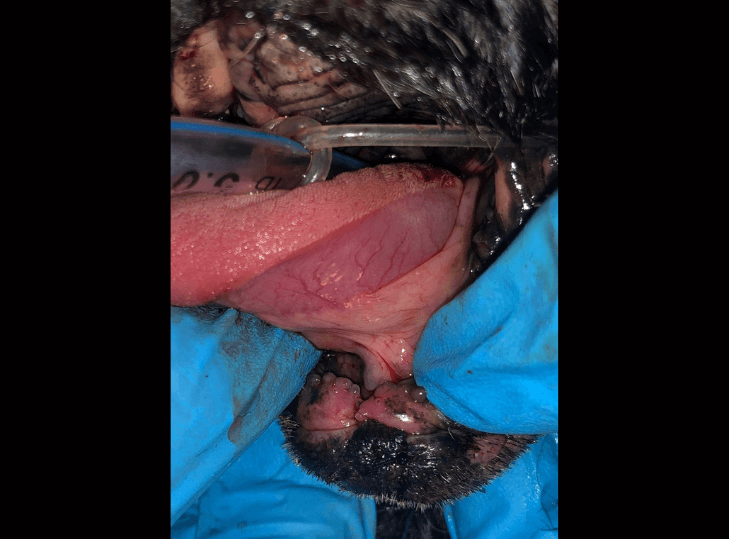 reforming lip vestible after mandibulectomy.jpg