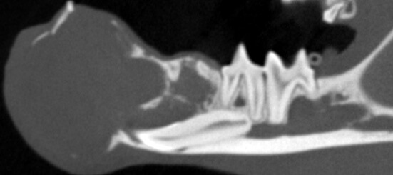 2 FIOT Rostral_MNectomy_Sep_2023_CT_08