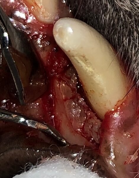 GTR - after bone graft placed, membrane on top